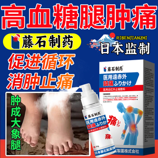 老人高血糖糖尿病脚肿小腿肿消肿神器周围神经病变去下肢部浮肿YZ