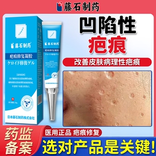 水痘疤痕祛痘印痘坑凹陷性凹洞修复膏男女淡化去痘印痘疤除疤膏WQ