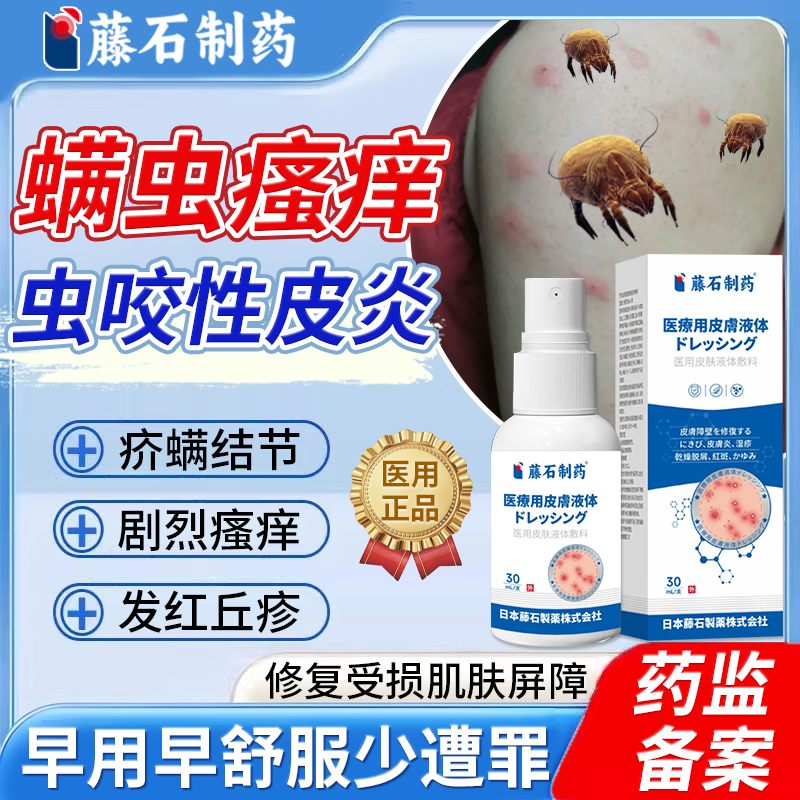 螨虫叮咬瘙痒红肿皮肤修复喷雾