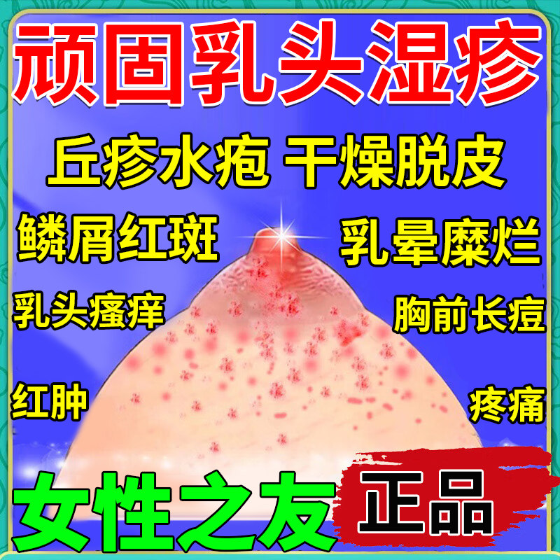 乳房湿疹膏乳头痒乳晕红斑小疙瘩瘙痒丘疹瘙痒糜烂水疱鳞屑苔藓aa