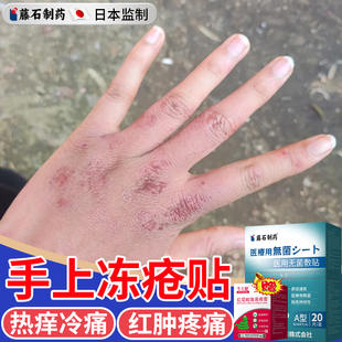 手指冻疮贴手脚裂口脚后跟干裂止痒冻伤贴专可搭治冻疮修复膏用DS