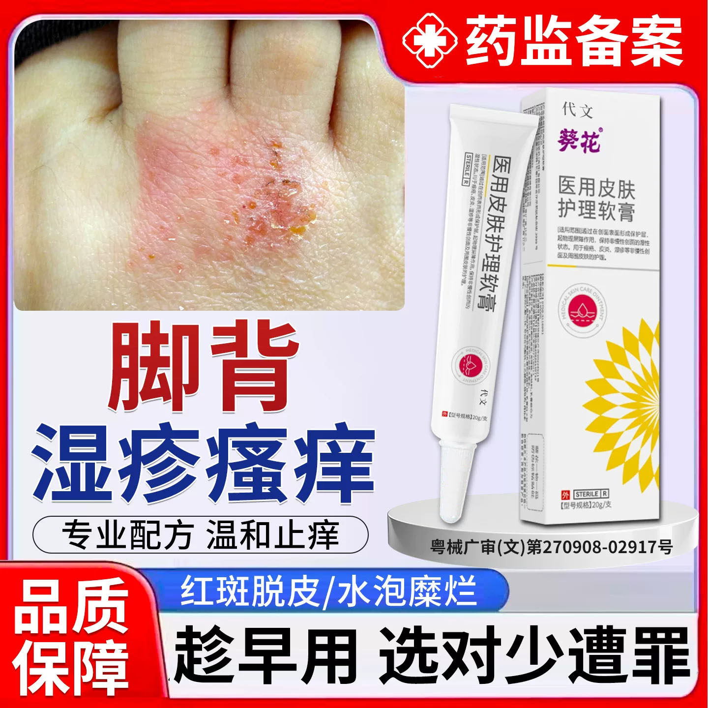 脚背瘙痒湿疹脚上水泡去除止痒红斑脚癣脱皮脚面发痒药房同款膏TU