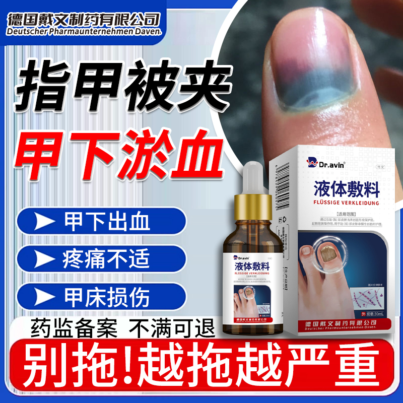 指甲淤血甲下出血修复液甲床受损