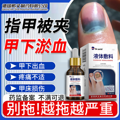 指甲淤血甲下出血修复液甲床受损
