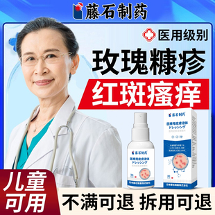 玫瑰糠疹皮肤瘙痒红斑疹专用喷雾根铜钱癣体癣康疹除药房同售DS