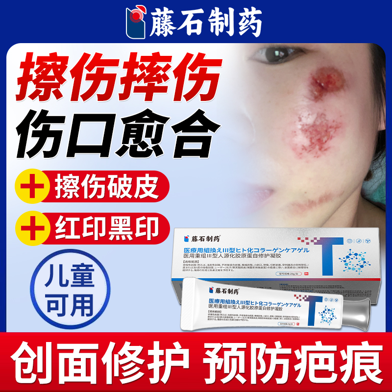 擦伤摔伤愈合修复预防留疤留印