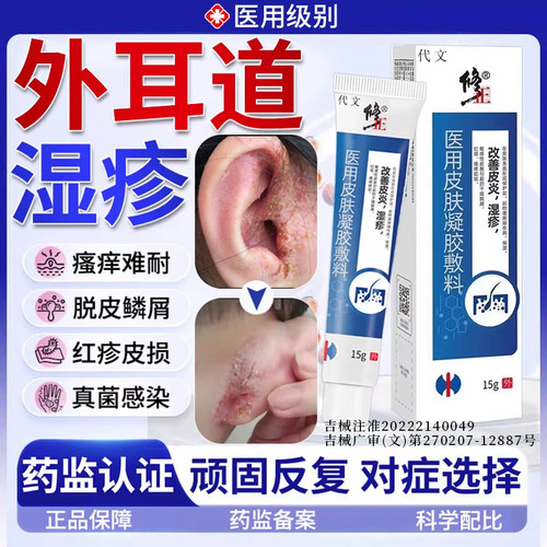 外耳道炎湿疹真菌感染