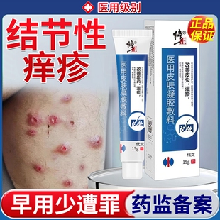 结节性痒疹皮肤湿疹治特顽固效红硬疙瘩皮炎瘙痒去止痒根抑菌膏VQ