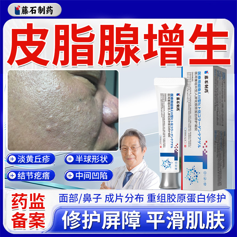 皮脂腺增生增大面部脸部鼻子小疙瘩囊肿修复专用软膏药房同售膏WQ