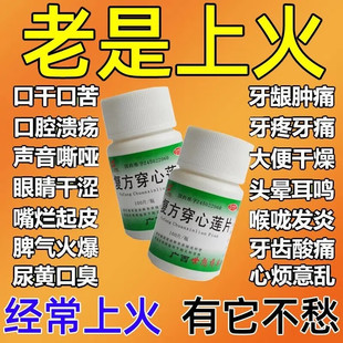 复方穿心莲片心火旺中成药心火旺吃什么药口干口苦清热解毒去肝火