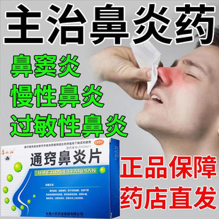 正品通窍鼻炎片儿童鼻窦炎中药口服药治疗的中成药非修正颗粒鼻渊