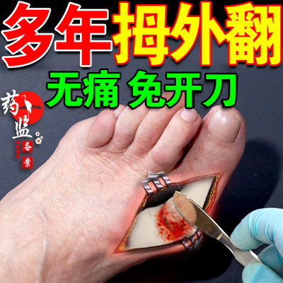 北京同仁堂拇指外翻膏药