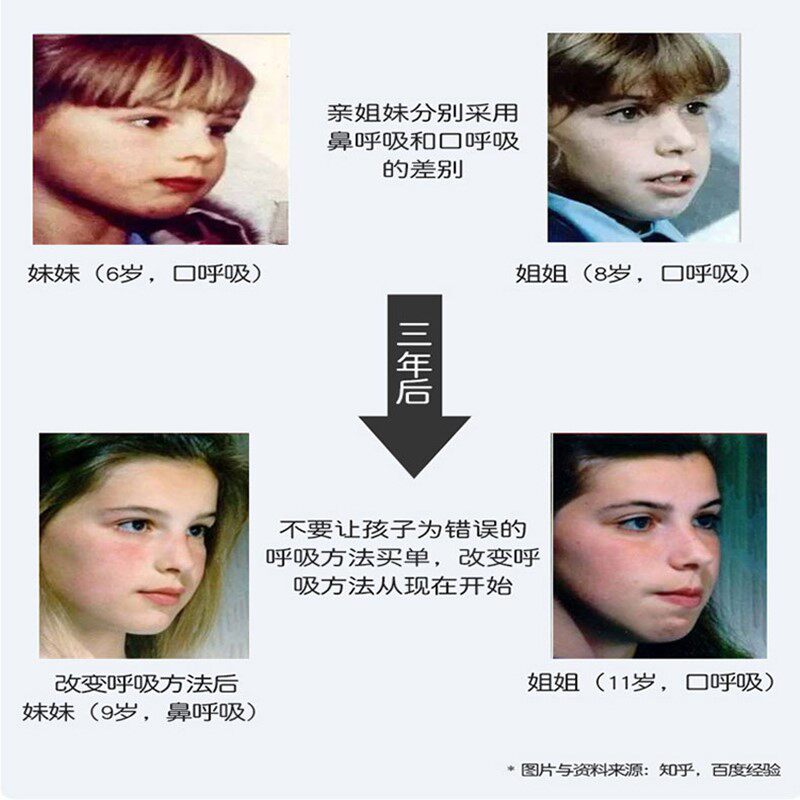 睡觉防张嘴巴大人嘴唇封嘴贴儿童睡眠闭合封口张嘴嘴巴嘴贴器