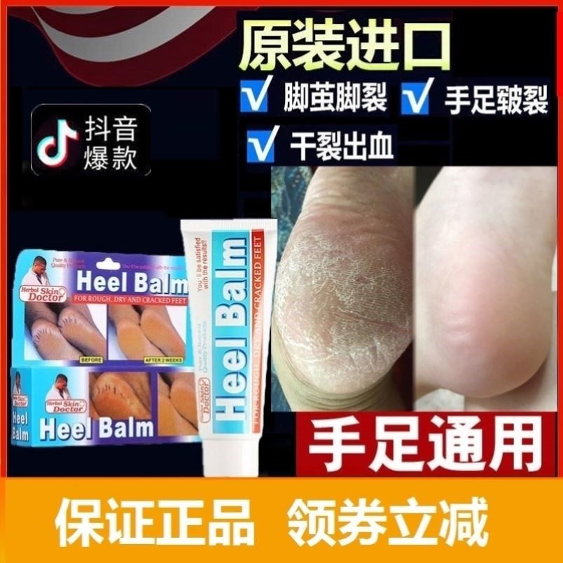 美国乐呋手足官网正品原装防干裂脚裂霜手脱皮套装裂膏脚后跟龟裂,3C数码配件,USB多功能数码宝,淘宝优惠券,粉丝福利购,淘宝优惠卷