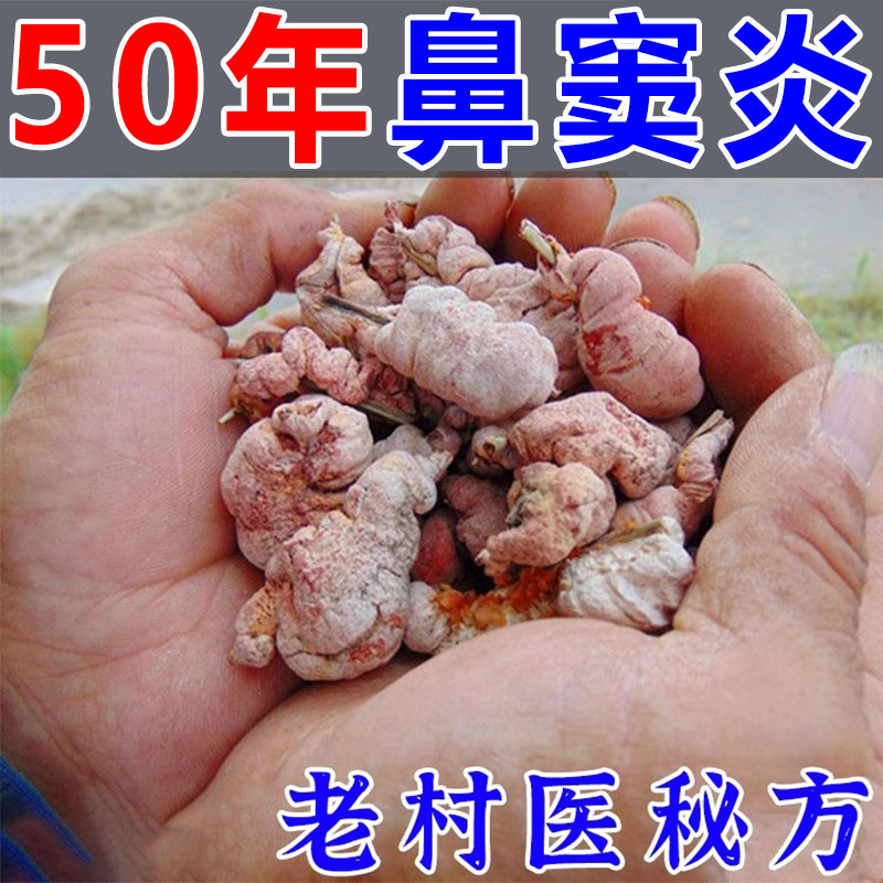 101%治疗鼻炎特效药儿童过敏性鼻炎贴眼睛痒鼻甲肥大呼吸不通气