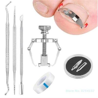 Ingrown Toenail Tools Include Ingrown Toenail Lifter Buckle