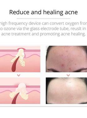 Portable Electrode High Frequency Facial Machine Acne Spot W