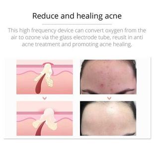 Portable Electrode High Frequency Facial Machine Acne Spot W