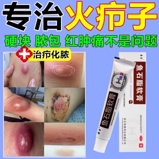 华青鱼石脂软膏早期疖肿帮助消炎消肿火疖子缓解红肿疼痛促进成熟
