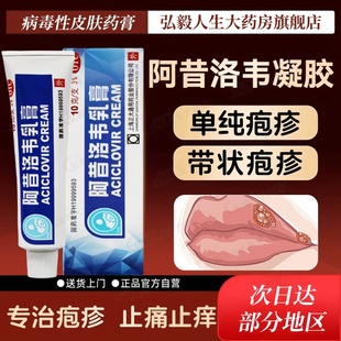 阿昔洛韦软膏乳膏正大嘴唇角炎带状疱疹后遗症神经痛药膏