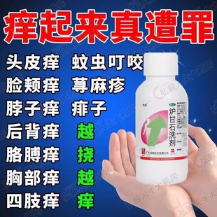 包邮 南国炉甘石洗剂100ml皮炎湿疹洗液止痒皮肤病痱子洗剂瘙痒