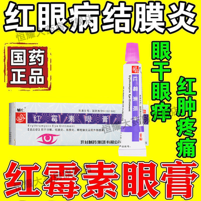 治眼睛充血红肿刺痛眼干眼痒怕光流眼泪红眼病结膜炎药红霉素眼膏