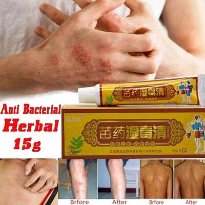 1 Piece Health Care Skin Fungus Anti Bacterial Cream Natural
