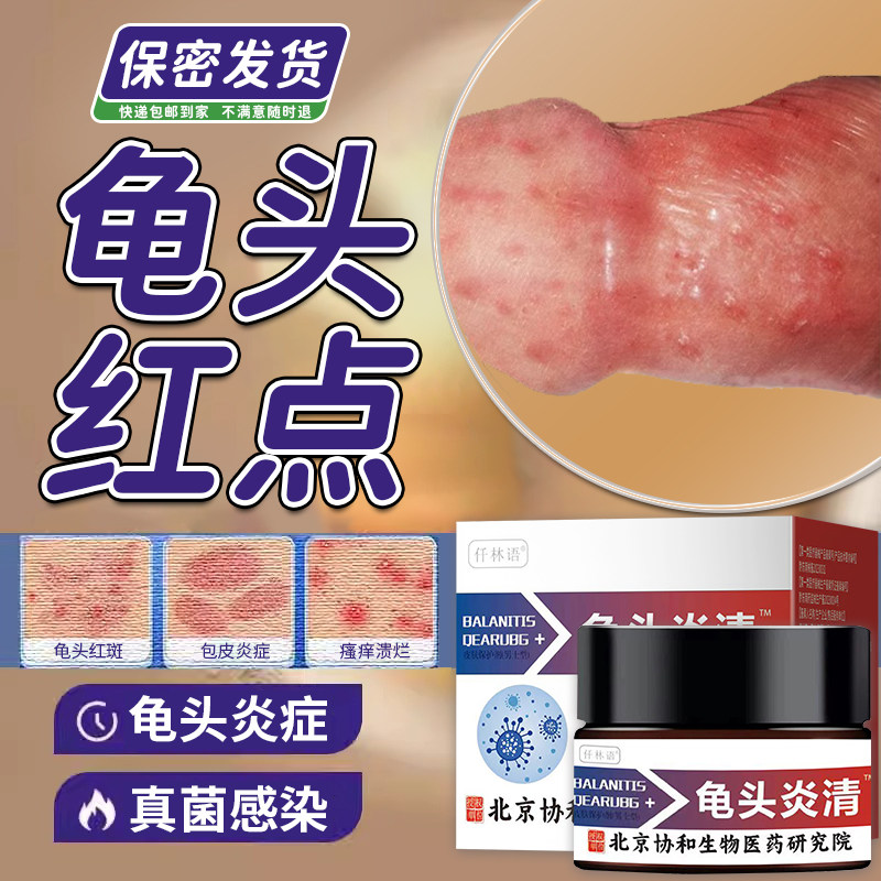 龟头皮下面豆腐渣白垢霉菌性龟头炎症专用可搭膏药水泡真菌感染or