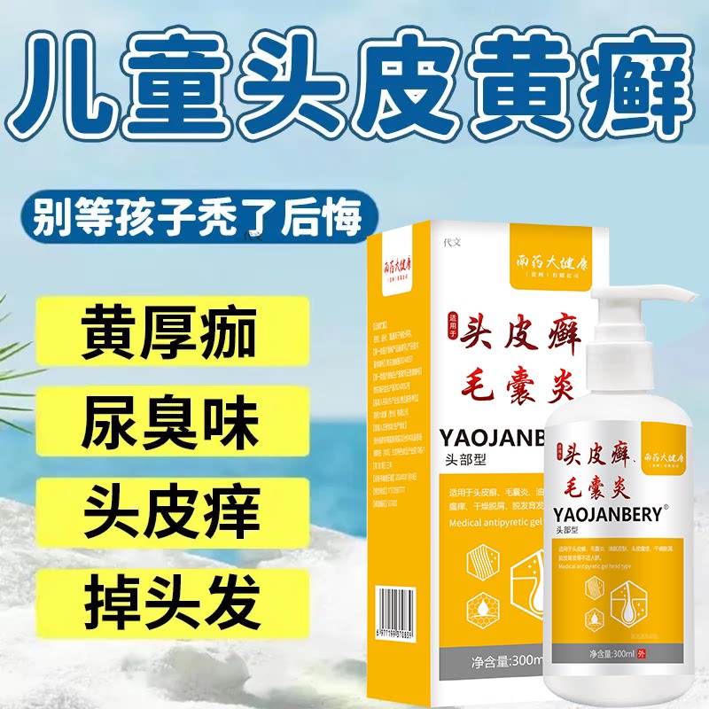 儿童头皮黄癣可搭止痒药膏真菌感染头癣红斑黄癣结痂露男女ik
