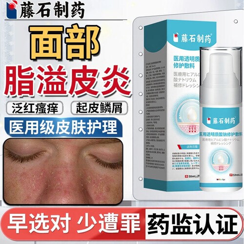 【藤石制药】脂溢性皮炎泛红起皮