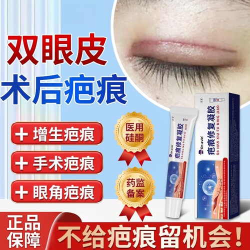 双眼皮术后祛疤膏--医用硅酮祛疤