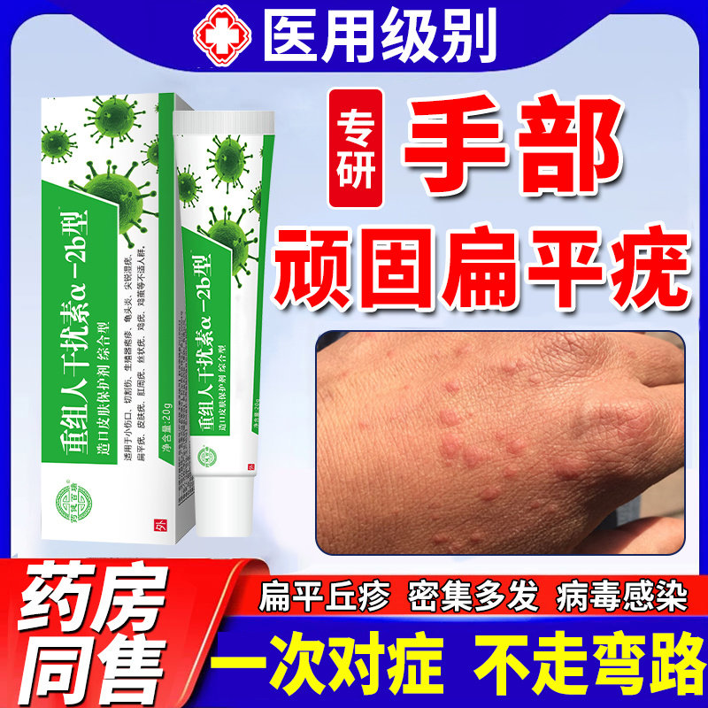 手背扁平疣干扰素凝胶软膏祛疣瘊子猴子hpv去疣扁皮疣可搭药膏ht