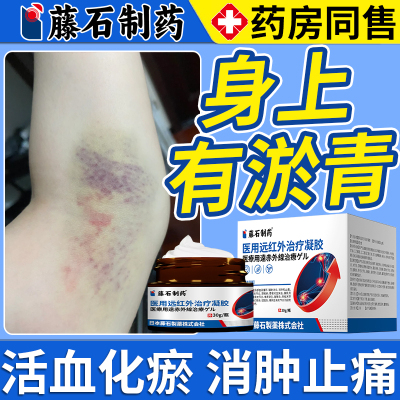 藤石制药磕碰摔伤身上淤青