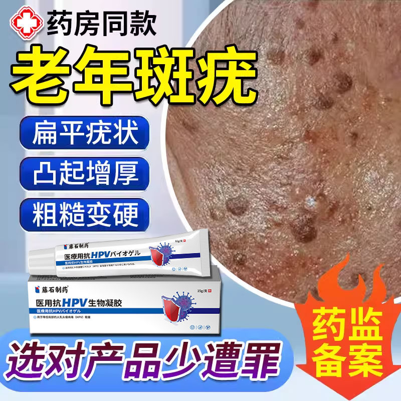 脸上扁平疣专用老年斑增厚凸起老人疣专用一抹灵脸部黑斑去除膏TU
