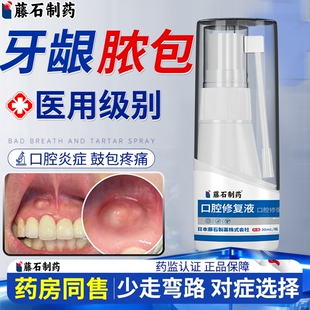 牙龈脓包肿痛消炎专用牙根发炎口腔牙周炎牙疼喷剂药房同款牙膏HT