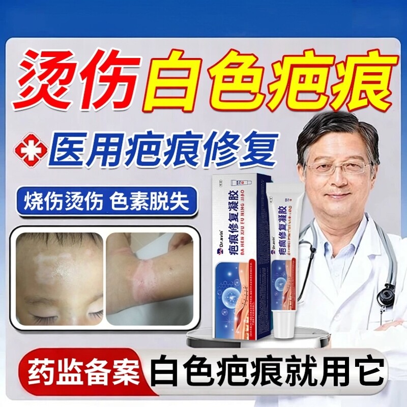 油烫伤烧伤白色疤痕色素脱失疤痕修复去黑色素沉淀去疤膏凝胶DS