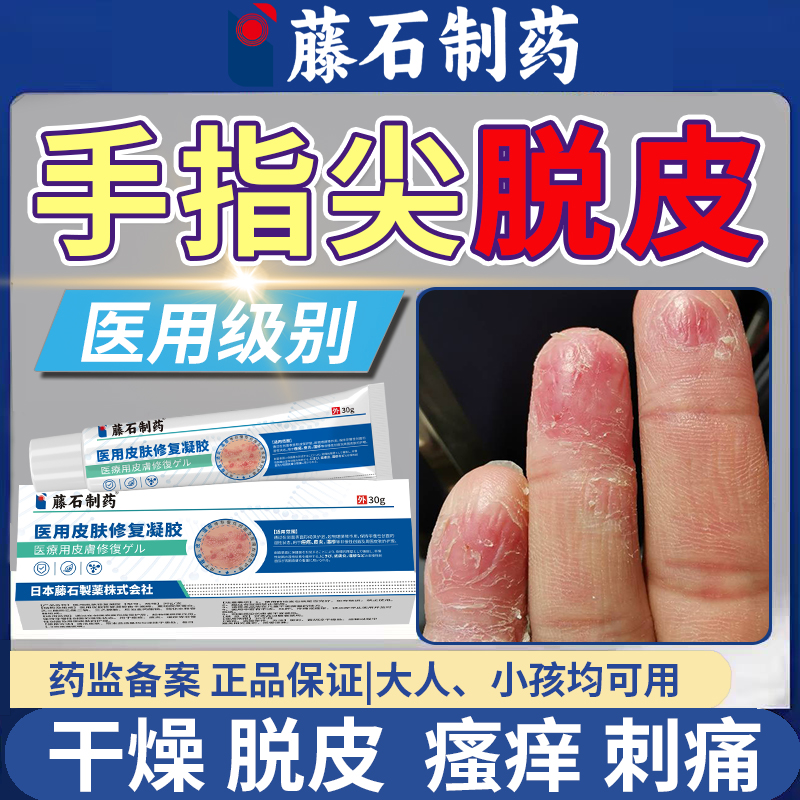 手指头指肚脱皮开裂【药监认证】