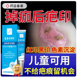 掉痂后去红印黑印疤印伤疤修复膏擦伤摔伤祛疤膏去除黑色素沉淀HT