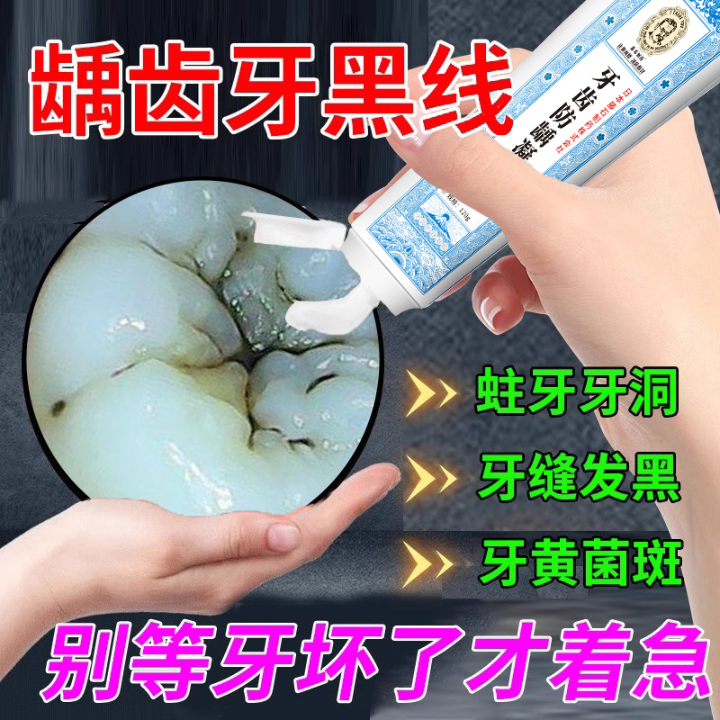 牙齿缝隙黑去牙斑菌浅龋有牙黑线牙黑斑除清除牙菌斑可搭牙膏用VQ