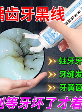 牙齿缝隙黑去牙斑菌浅龋有牙黑线牙黑斑除清除牙菌斑可搭牙膏用VQ