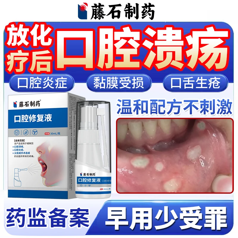 放疗化疗后反复口腔溃疡黏膜炎症口舌生疮专用喷剂神器药房同售VQ