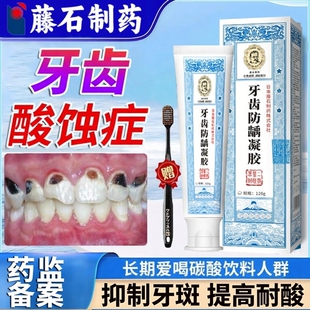 酸蚀症牙黑斑去除祛黑线有牙釉质牙膏非液牙齿敏感酸痛蛀牙DS