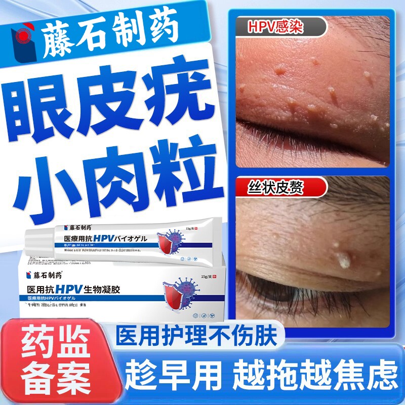 眼皮眼角上长小肉粒神器丝状疣去除医用祛疣瘊扁平疣药房同售膏DS