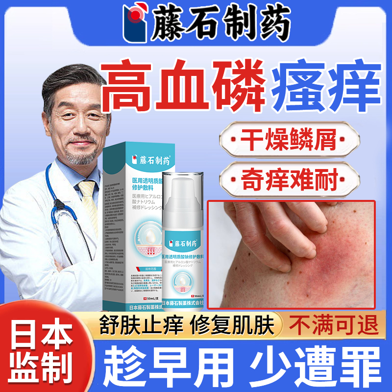 藤石透明质酸钠敷料高血磷皮肤痒