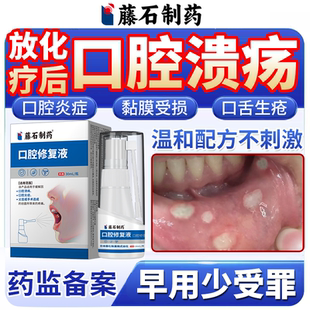 放疗化疗后反复口腔溃疡黏膜炎症口舌生疮专用喷剂神器药房同售VQ