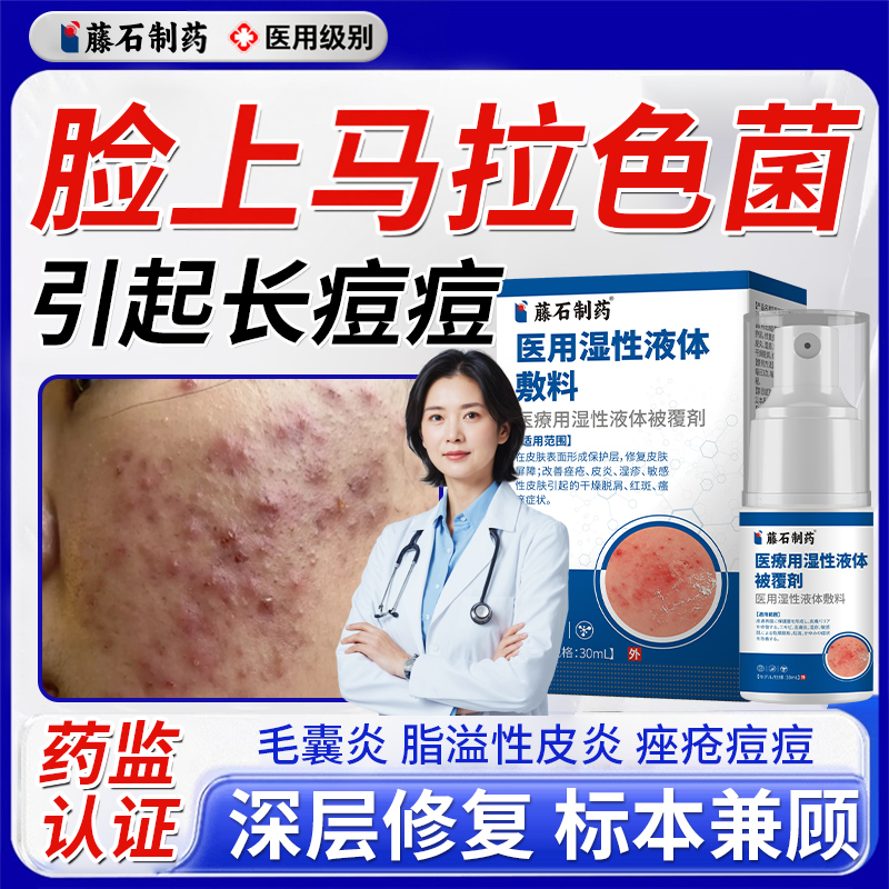 面部马拉色菌喷雾脸部螨虫长痘毛囊炎脂溢性皮炎痤疮药房同售膏WQ