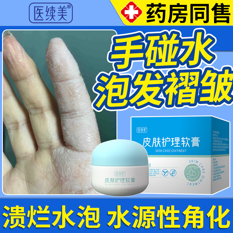 角化型湿疹手癣水泡型脱皮干裂真菌感染止痒去手藓根药房同售膏DS