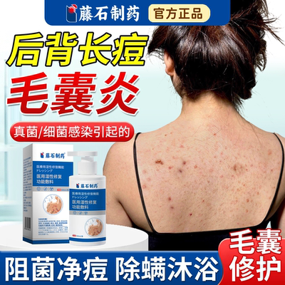 【速发】后背长痘痘毛囊炎沐浴露