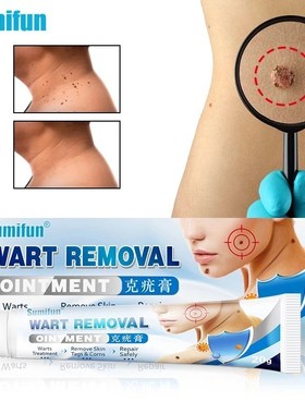 Wart Cream Skin Tag Remover Antibacterial Cream Mole Wart