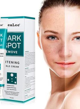 Whitening And Freckle Cream Lightening Pigmentation Mild Fre